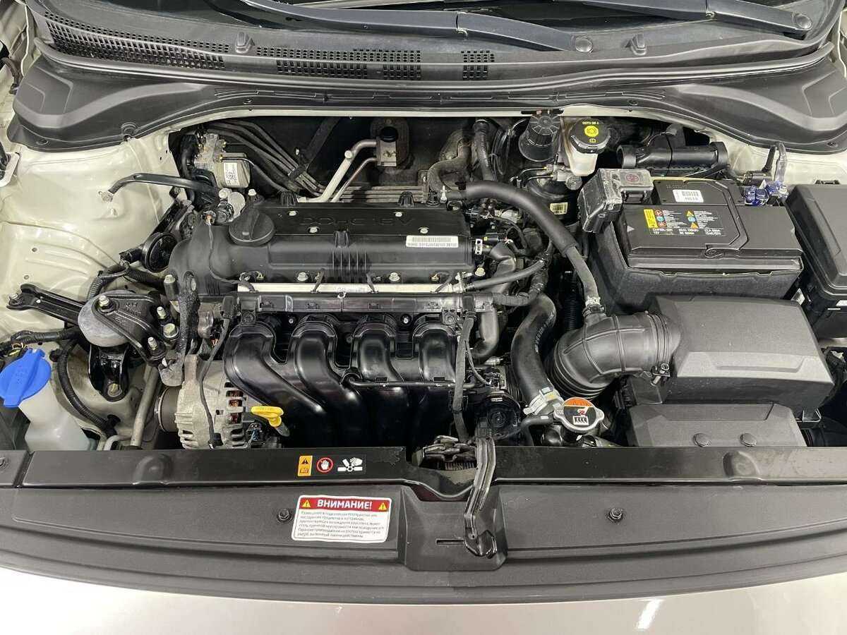 Hyundai Solaris с пробегом — 2018 год. Фото: #15